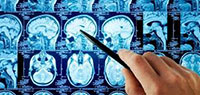 Neurosurgery